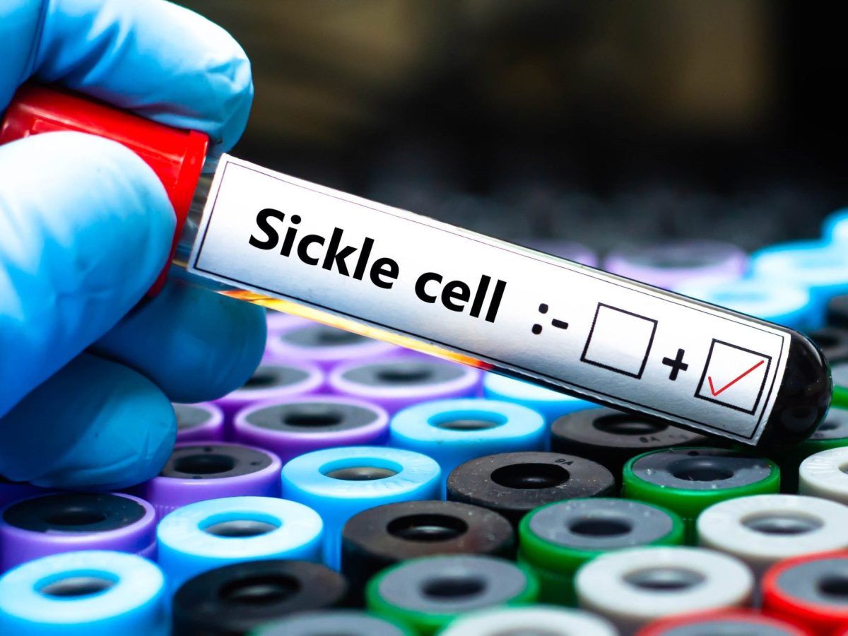 New hope for sickle cell disease: FDA approves gene therapies Casgevy and Lyfgenia